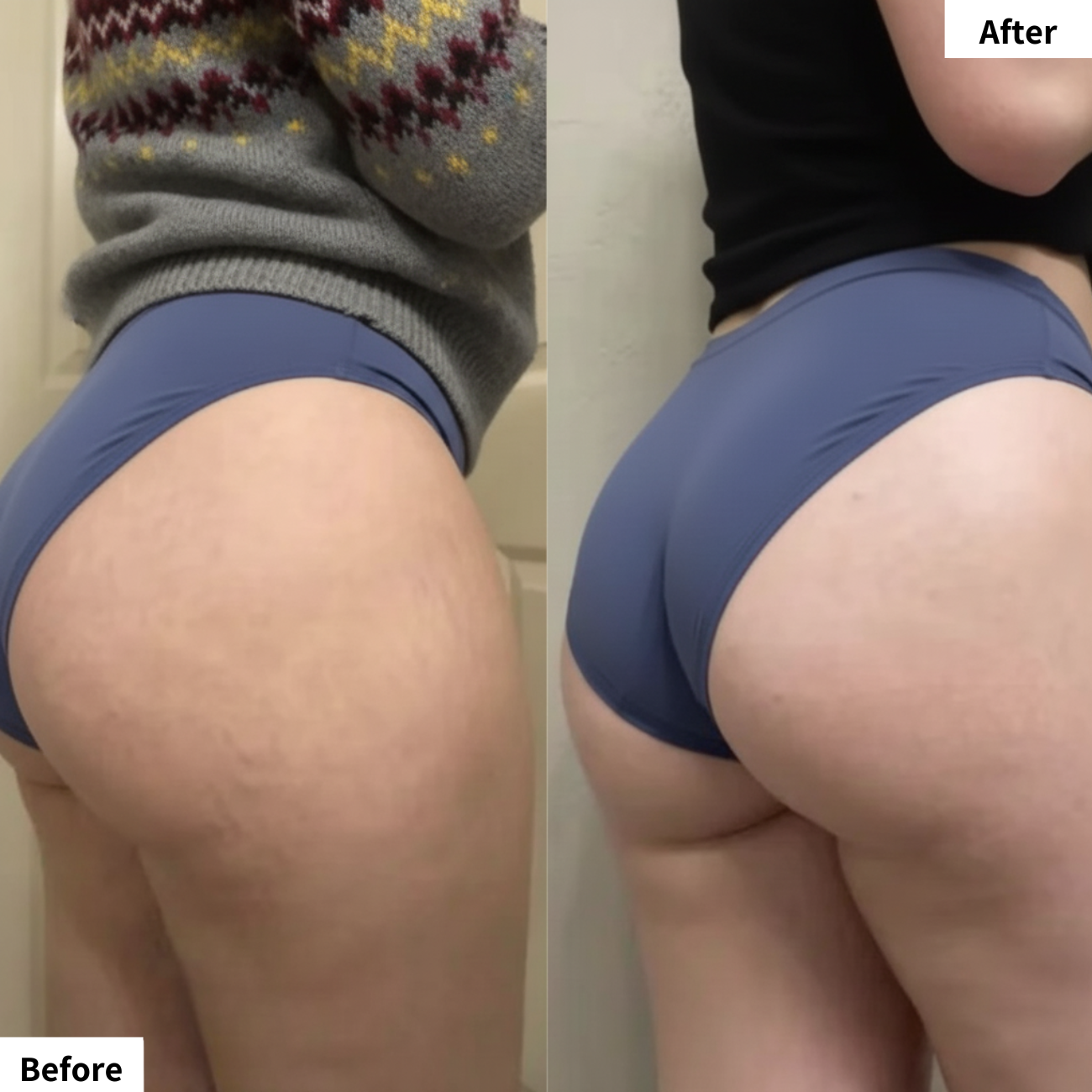 PerfectShape MAX – Booty, Abs & Arms Trainer