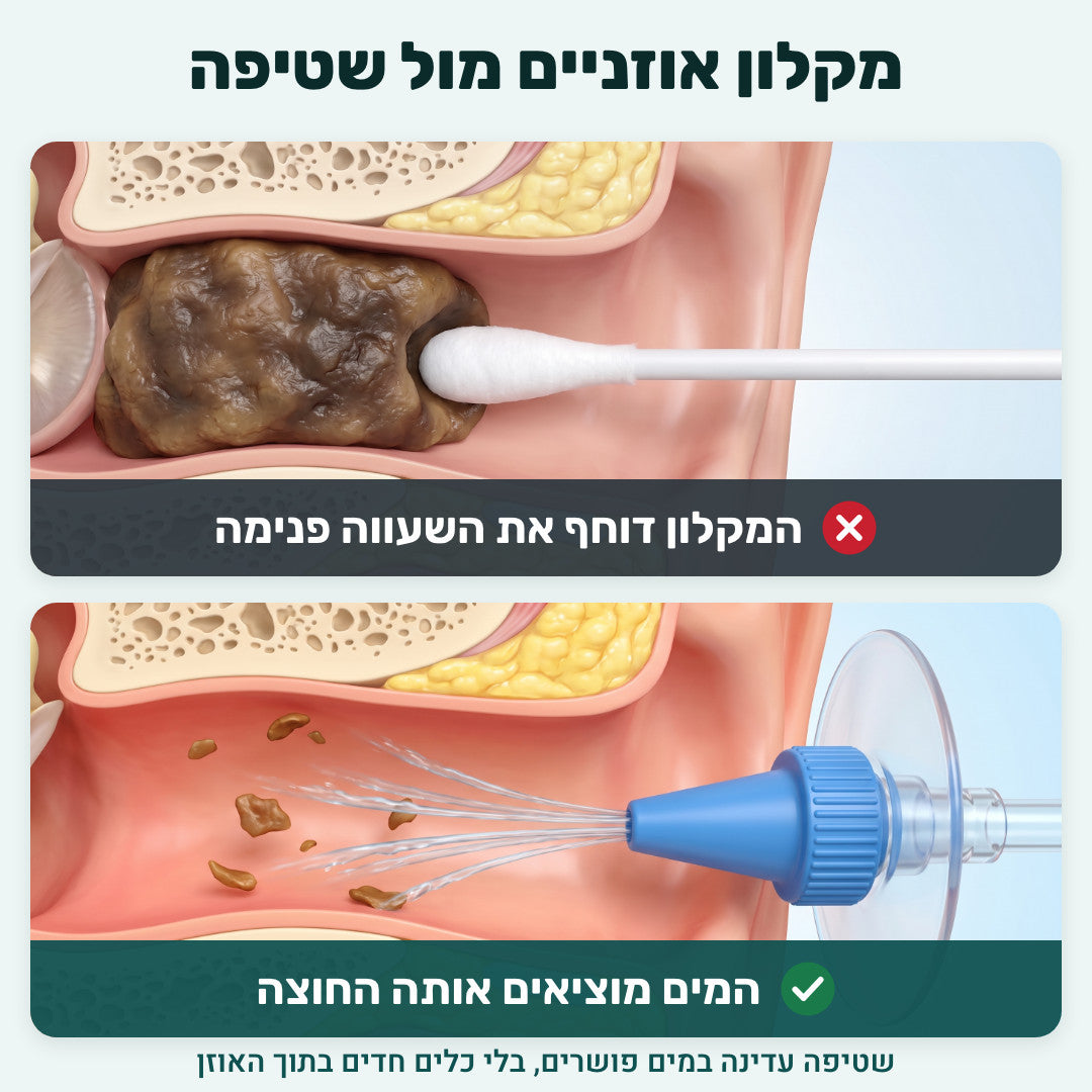 מקלון אוזניים מול שטיפה: המקלון דוחף את השעווה פנימה, המים מוציאים אותה החוצה